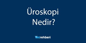 Üroskopi Nedir?